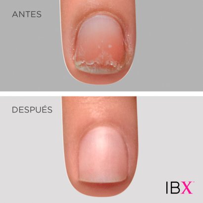 RECUPERA TUS UÑAS DAÑADAS CON IBX